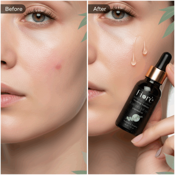 Eucalyptus Oil - Image 3